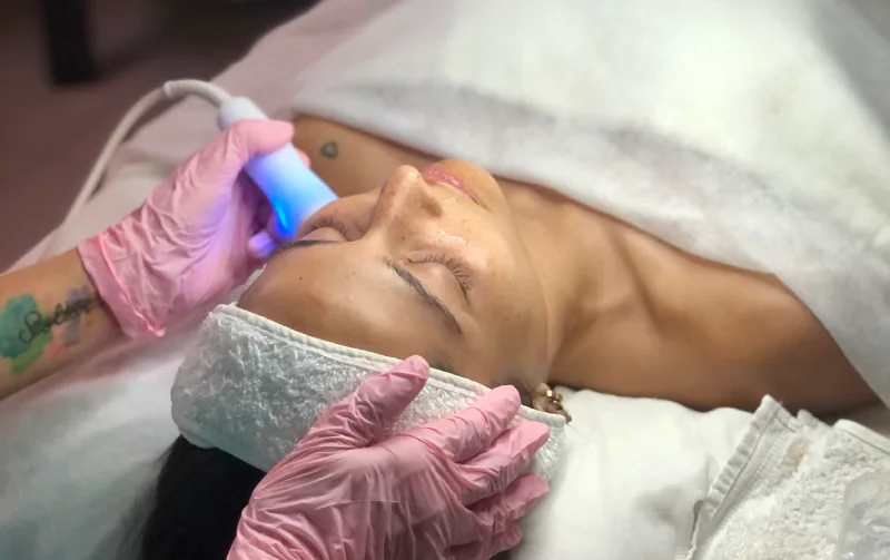 Limpieza facial con radiofrecuencia o electroporacion